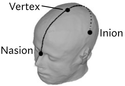 Nasion-Inion Distance Measurement
