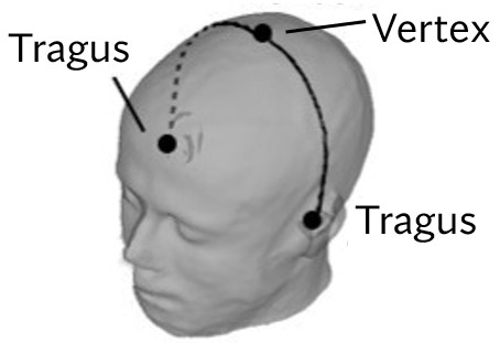 Tragus-Tragus Distance Measurement