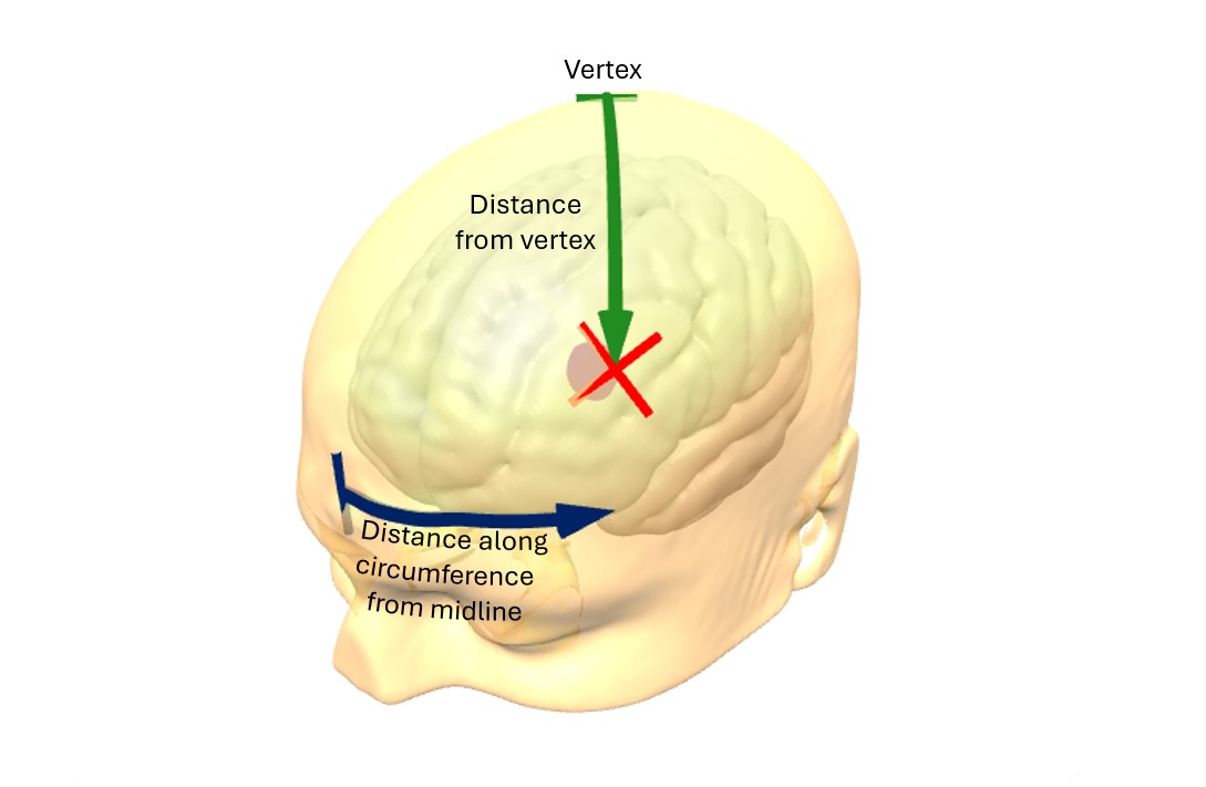 TMS Targeting Result